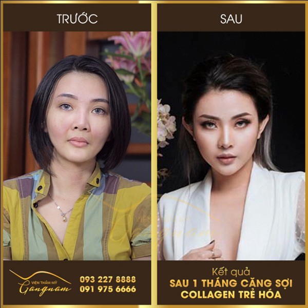 that hu ve cong nghe tre dep vuot thoi gian - 2